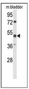Parvin Alpha antibody, AP53170PU-N, Origene, Western Blot image 