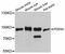 High affinity cAMP-specific and IBMX-insensitive 3 ,5 -cyclic phosphodiesterase 8A antibody, A12187, ABclonal Technology, Western Blot image 