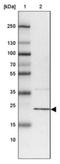 RWD Domain Containing 1 antibody, NBP1-80871, Novus Biologicals, Western Blot image 