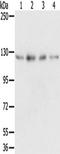 RNA-binding protein 5 antibody, TA350337, Origene, Western Blot image 