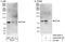 Eyes absent homolog 4 antibody, A302-628A, Bethyl Labs, Western Blot image 