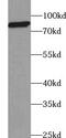 Ubiquitin carboxyl-terminal hydrolase 35 antibody, FNab09328, FineTest, Western Blot image 