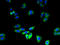 E3 ubiquitin-protein ligase RNF128 antibody, A66550-100, Epigentek, Immunofluorescence image 