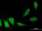 Adaptor Protein, Phosphotyrosine Interacting With PH Domain And Leucine Zipper 2 antibody, H00055198-M06, Novus Biologicals, Immunofluorescence image 
