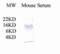 Complement C3 antibody, GTX78199, GeneTex, Western Blot image 