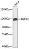 Fibroblast Growth Factor Receptor 2 antibody, 13-014, ProSci, Western Blot image 