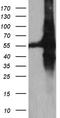 Rho GDP-dissociation inhibitor 1 antibody, TA811044, Origene, Western Blot image 