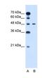 Pre-B-cell leukemia transcription factor 1 antibody, orb329587, Biorbyt, Western Blot image 