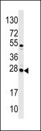 Casein Alpha S1 antibody, 62-319, ProSci, Western Blot image 