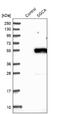 Sarcoglycan Alpha antibody, NBP1-90306, Novus Biologicals, Western Blot image 