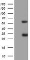 Mesothelin antibody, CF805171, Origene, Western Blot image 