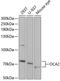 OCA2 Melanosomal Transmembrane Protein antibody, A01587, Boster Biological Technology, Western Blot image 