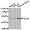 Ferrochelatase, mitochondrial antibody, A8418, ABclonal Technology, Western Blot image 
