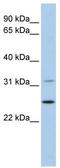 Dehydrogenase/Reductase 1 antibody, TA340297, Origene, Western Blot image 