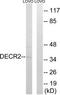 2,4-Dienoyl-CoA Reductase 2 antibody, TA315307, Origene, Western Blot image 