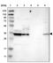 Carbonyl Reductase 3 antibody, PA5-53800, Invitrogen Antibodies, Western Blot image 