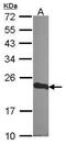 Cysteine Rich Protein 1 antibody, PA5-29999, Invitrogen Antibodies, Western Blot image 
