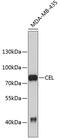Carboxyl Ester Lipase antibody, 19-159, ProSci, Western Blot image 