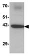 Dorsal Inhibitory Axon Guidance Protein antibody, GTX31456, GeneTex, Western Blot image 