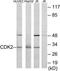 Cyclin Dependent Kinase 2 antibody, TA313151, Origene, Western Blot image 
