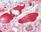 C4BPA antibody, LS-B9692, Lifespan Biosciences, Immunohistochemistry paraffin image 