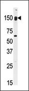 Cytoplasmic Linker Associated Protein 2 antibody, 62-710, ProSci, Western Blot image 