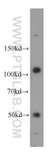 CSN3 antibody, 55277-1-AP, Proteintech Group, Western Blot image 