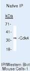 Cyclin Dependent Kinase 4 antibody, AHZ0202, Invitrogen Antibodies, Immunoprecipitation image 