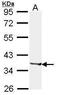 Alcohol Dehydrogenase 1B (Class I), Beta Polypeptide antibody, PA5-29898, Invitrogen Antibodies, Western Blot image 