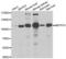Membrane-bound transcription factor site-1 protease antibody, PA5-77103, Invitrogen Antibodies, Western Blot image 