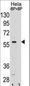 SMAD Family Member 5 antibody, LS-C156109, Lifespan Biosciences, Western Blot image 