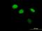 Zinc Finger And BTB Domain Containing 12 antibody, H00221527-B01P, Novus Biologicals, Immunofluorescence image 