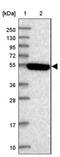 Keratin 74 antibody, NBP2-14645, Novus Biologicals, Western Blot image 