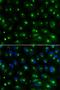 Golgi Associated, Gamma Adaptin Ear Containing, ARF Binding Protein 2 antibody, orb49087, Biorbyt, Immunofluorescence image 
