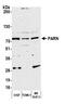 Poly(A)-Specific Ribonuclease antibody, A303-562A, Bethyl Labs, Western Blot image 