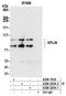 LIM domain and actin-binding protein 1 antibody, A300-225A, Bethyl Labs, Immunoprecipitation image 