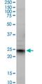 Ephrin A5 antibody, H00001946-M01, Novus Biologicals, Western Blot image 