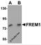 FRAS1 Related Extracellular Matrix 1 antibody, 5829, ProSci, Western Blot image 