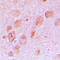 Ribosomal Protein L17 antibody, LS-C352796, Lifespan Biosciences, Immunohistochemistry frozen image 
