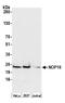 NOP16 Nucleolar Protein antibody, A305-125A, Bethyl Labs, Western Blot image 