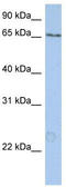 Pumilio RNA Binding Family Member 3 antibody, TA339320, Origene, Western Blot image 
