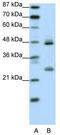 Kruppel Like Factor 6 antibody, TA339058, Origene, Western Blot image 