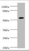 Epoxide Hydrolase 2 antibody, A50213-100, Epigentek, Western Blot image 