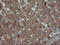 Carboxypeptidase A2 antibody, M06401-1, Boster Biological Technology, Immunohistochemistry paraffin image 