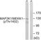Mitogen-Activated Protein Kinase Kinase Kinase 1 antibody, TA314186, Origene, Western Blot image 