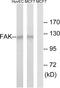 PTK2 antibody, TA312486, Origene, Western Blot image 