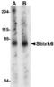 SLIT And NTRK Like Family Member 6 antibody, TA306532, Origene, Western Blot image 