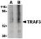 TNF Receptor Associated Factor 3 antibody, PA5-20165, Invitrogen Antibodies, Western Blot image 