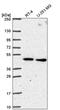 Calcium-binding mitochondrial carrier protein SCaMC-1 antibody, PA5-66609, Invitrogen Antibodies, Western Blot image 
