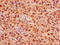 Forkhead Box K1 antibody, orb47355, Biorbyt, Immunohistochemistry paraffin image 